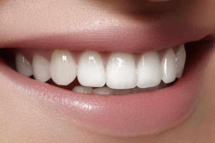 Zahnersatz in Zahnfarbe